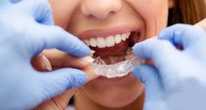 Consejos para ir al dentista durante el periodo de desescalada