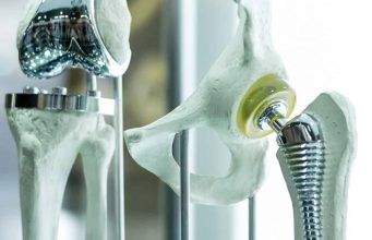 Los metales y su uso en los instrumentos médicos Los metales y su uso en los instrumentos médicos