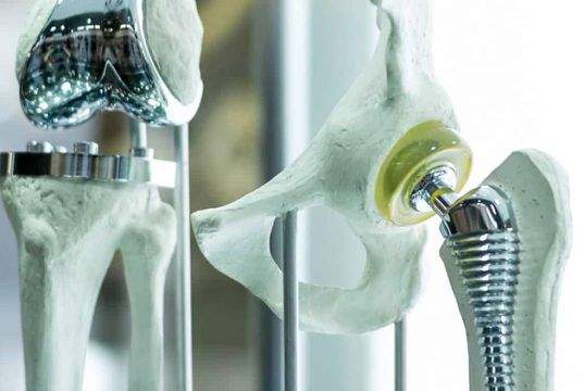 Los metales y su uso en los instrumentos médicos