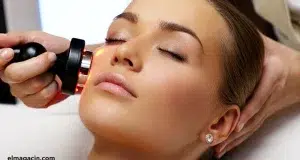 Radiofrecuencia facial