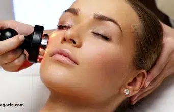 Radiofrecuencia facial