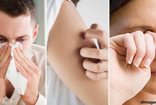 Los estornudos, la urticaria y los picores en los ojos son síntomas comunes entre distintos tipos de alergias